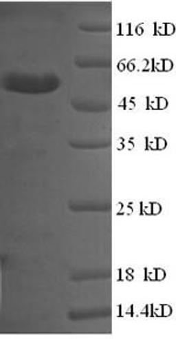 (Tris-Glycine gel) Discontinuous SDS-PAGE (reduced) with 5% enrichment gel and 15% separation gel.