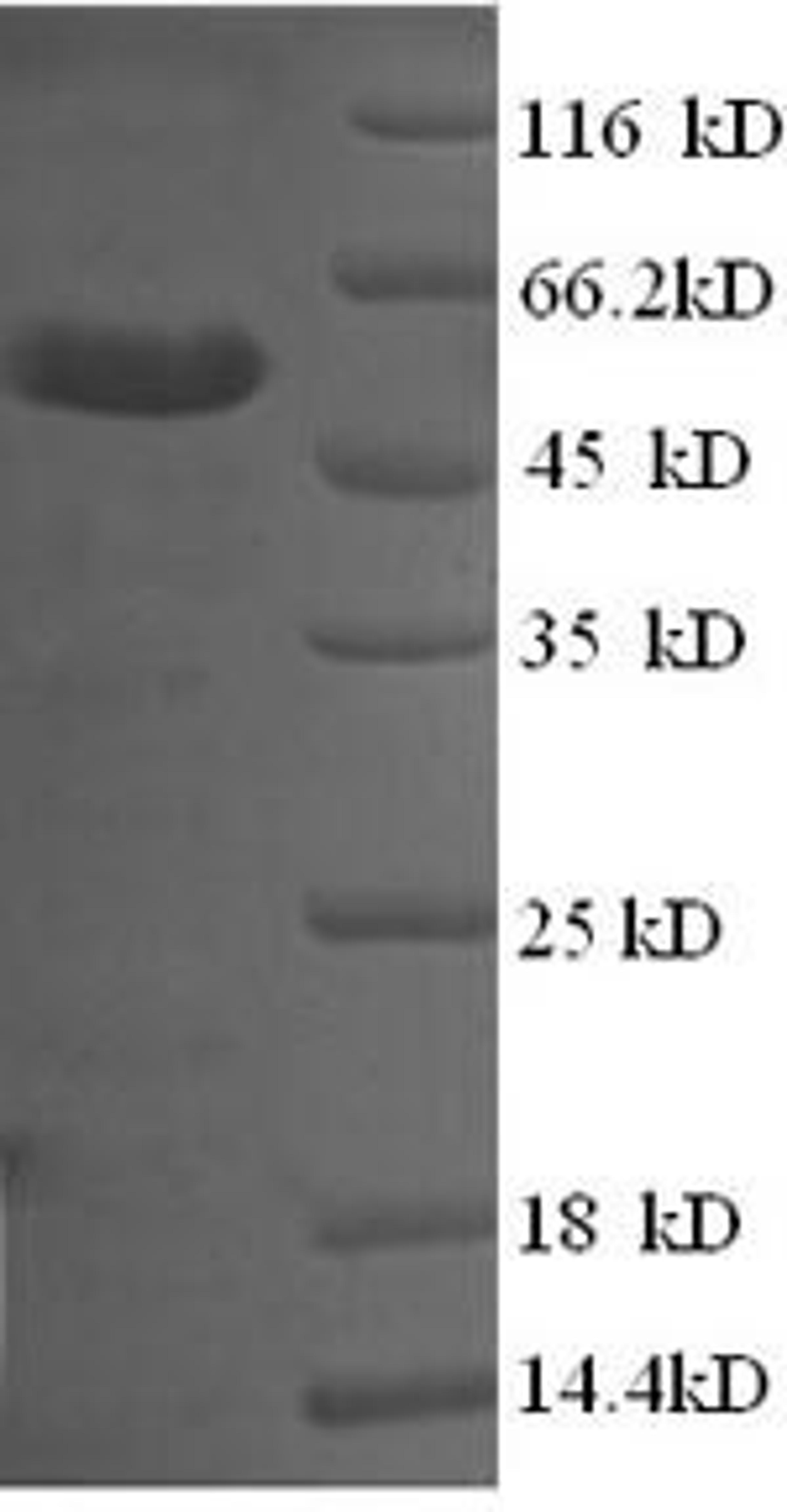 (Tris-Glycine gel) Discontinuous SDS-PAGE (reduced) with 5% enrichment gel and 15% separation gel.