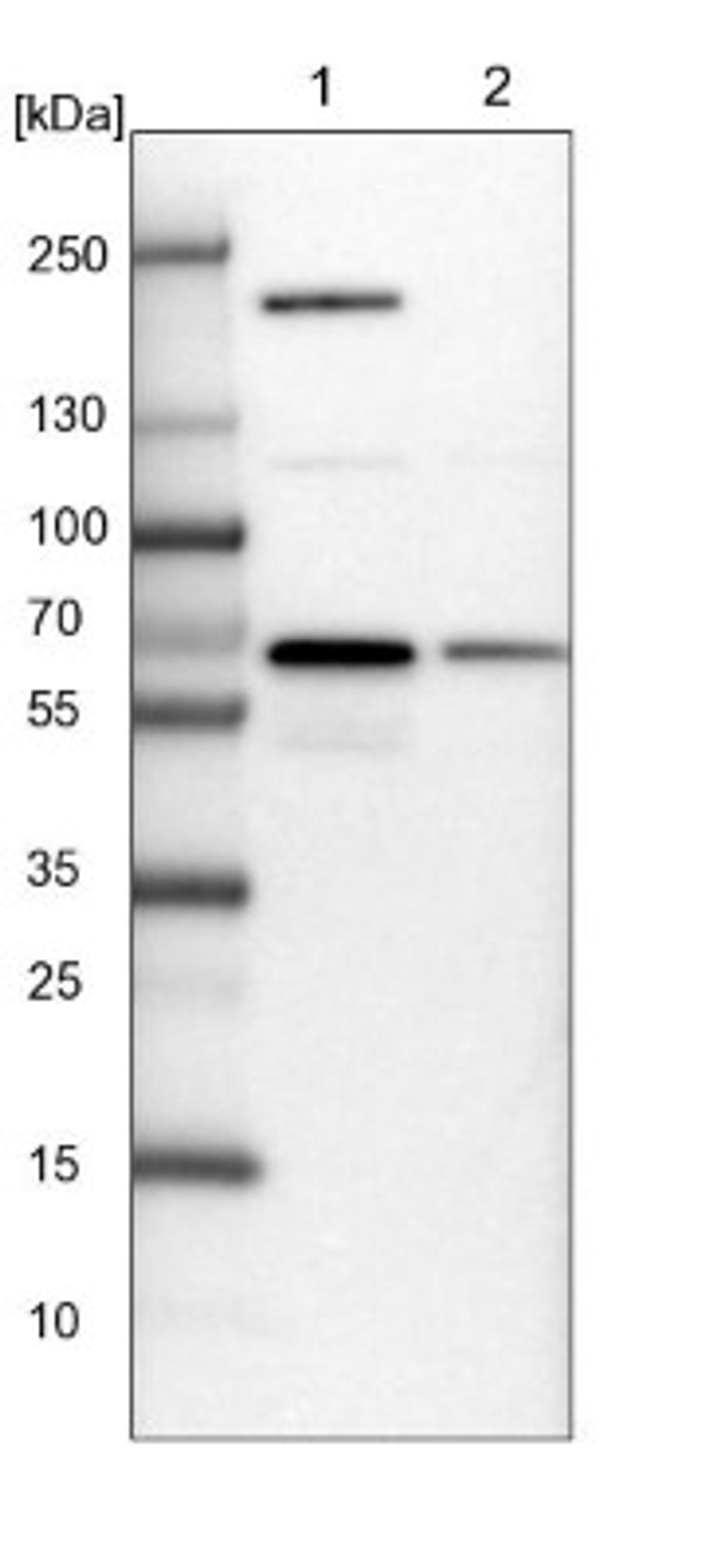 Western Blot: NARS Antibody [NBP2-13640] - Lane 1: NIH-3T3 cell lysate (Mouse embryonic fibroblast cells)<br/>Lane 2: NBT-II cell lysate (Rat Wistar bladder tumour cells)