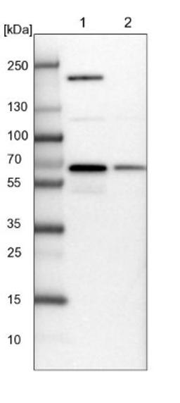 Western Blot: NARS Antibody [NBP2-13640] - Lane 1: NIH-3T3 cell lysate (Mouse embryonic fibroblast cells)<br/>Lane 2: NBT-II cell lysate (Rat Wistar bladder tumour cells)