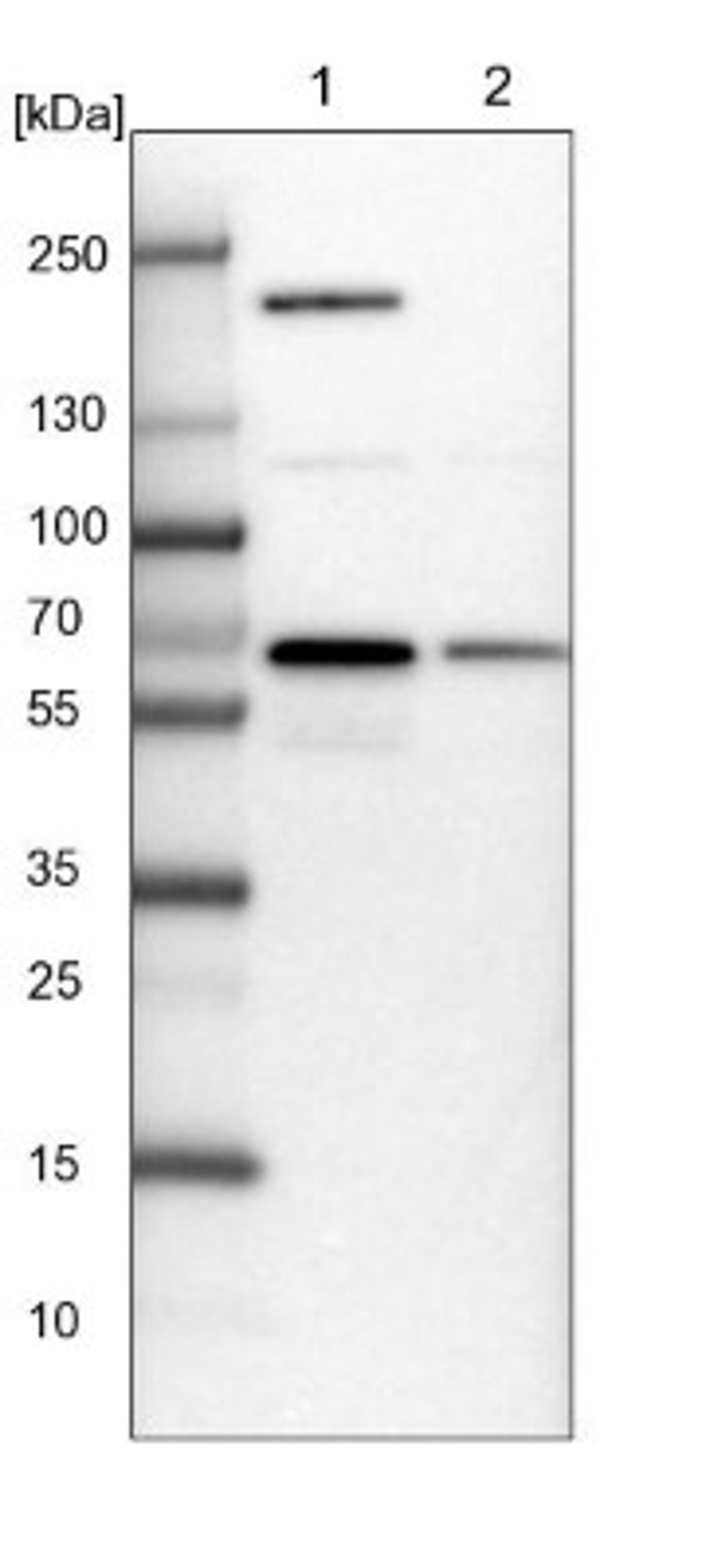 Western Blot: NARS Antibody [NBP2-13640] - Lane 1: NIH-3T3 cell lysate (Mouse embryonic fibroblast cells)<br/>Lane 2: NBT-II cell lysate (Rat Wistar bladder tumour cells)