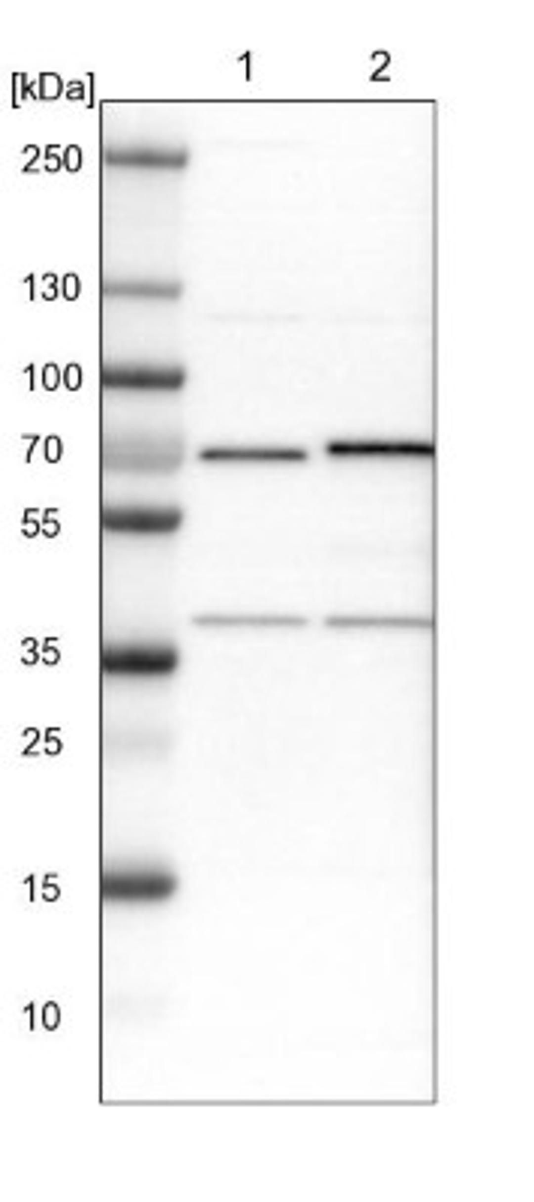 Western Blot: ASC1 Antibody [NBP1-89656] - Lane 1: NIH-3T3 cell lysate (Mouse embryonic fibroblast cells)<br/>Lane 2: NBT-II cell lysate (Rat Wistar bladder tumour cells)