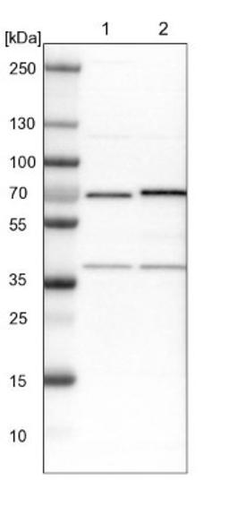 Western Blot: ASC1 Antibody [NBP1-89656] - Lane 1: NIH-3T3 cell lysate (Mouse embryonic fibroblast cells)<br/>Lane 2: NBT-II cell lysate (Rat Wistar bladder tumour cells)