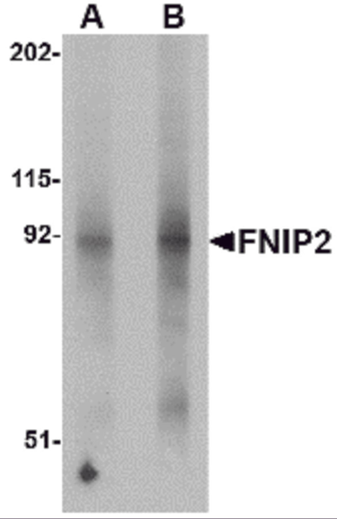 Western blot analysis of FNIP2 in mouse skeletal muscle lysate with FNIP2 antibody at (A) 1 and (B) 2 μg/mL.