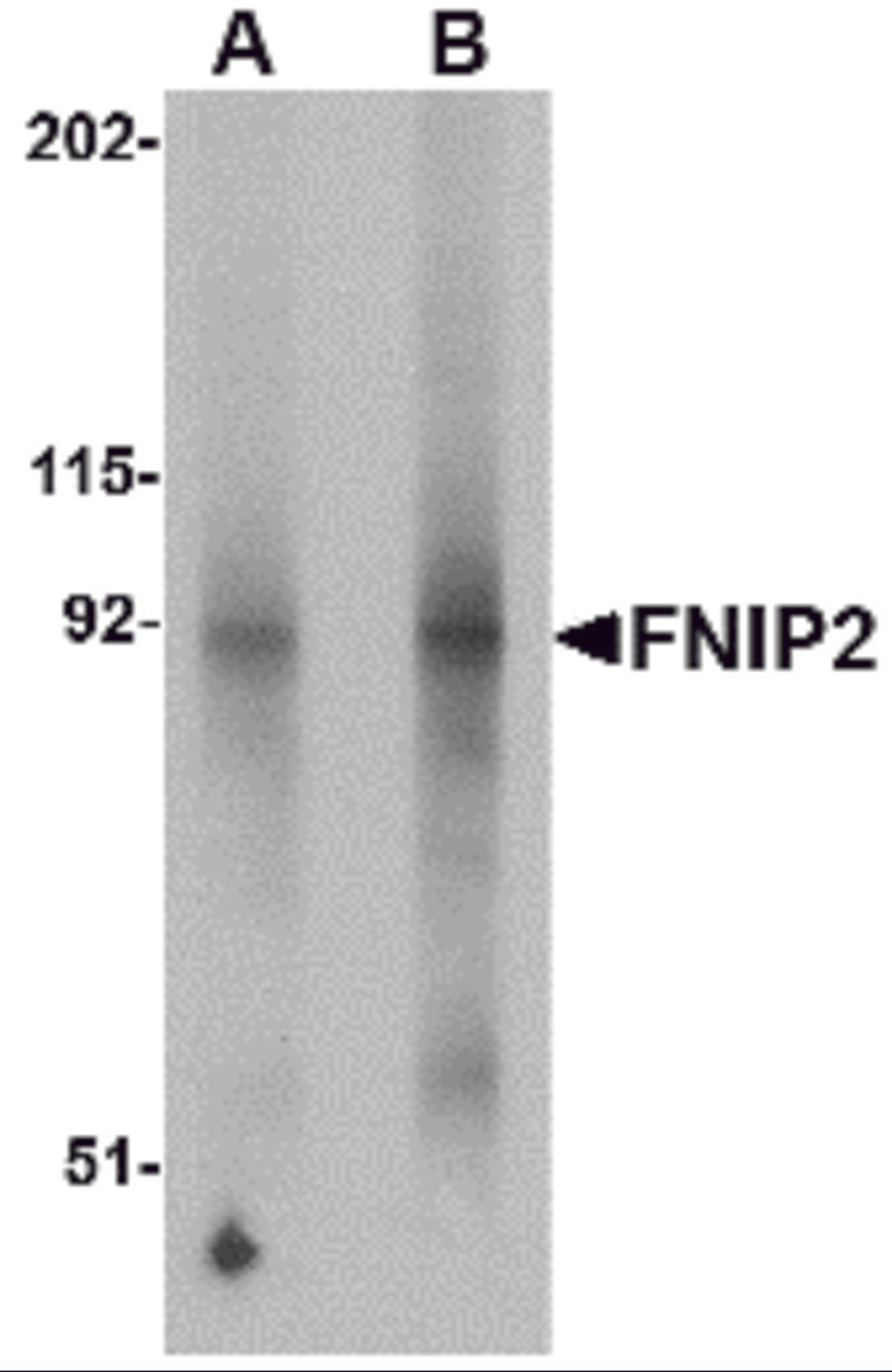 Western blot analysis of FNIP2 in mouse skeletal muscle lysate with FNIP2 antibody at (A) 1 and (B) 2 μg/mL.