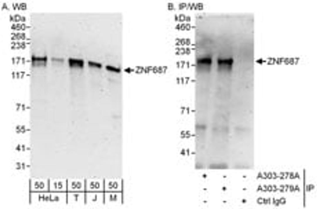 Detection of human and mouse ZNF687 by western blot (h and m) and immunoprecipitation (h).