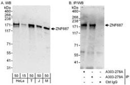 Detection of human and mouse ZNF687 by western blot (h and m) and immunoprecipitation (h).