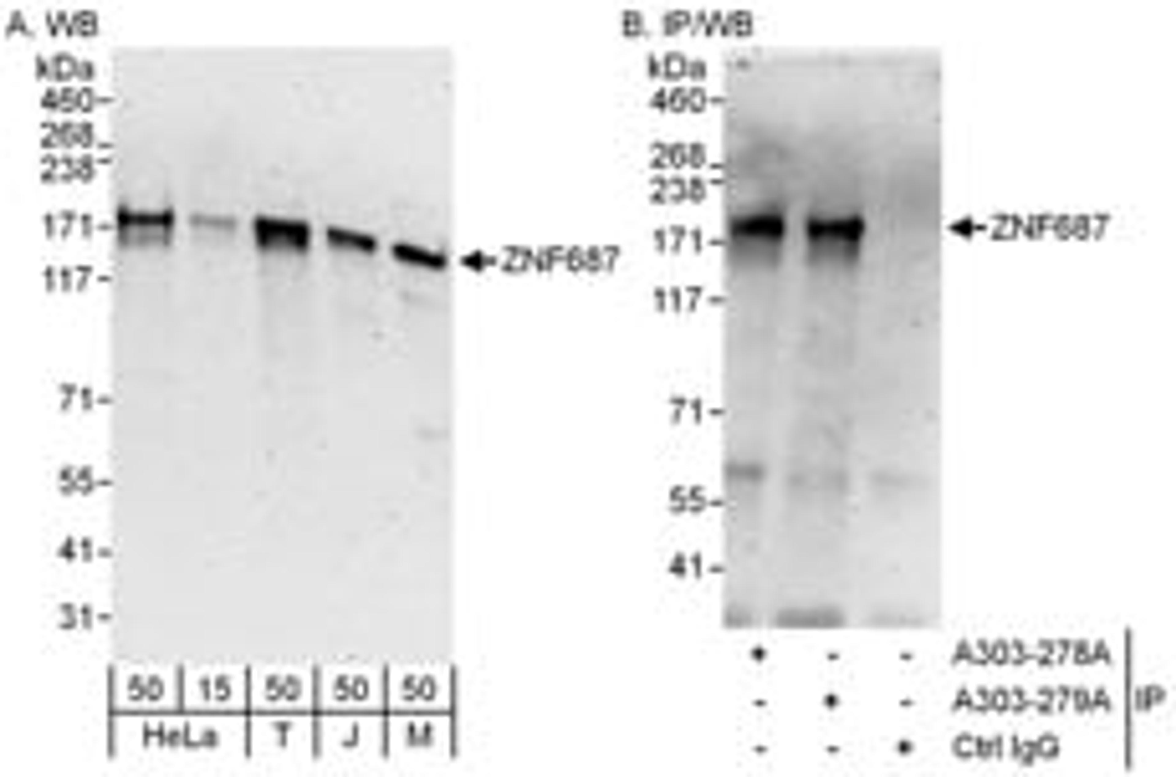 Detection of human and mouse ZNF687 by western blot (h and m) and immunoprecipitation (h).