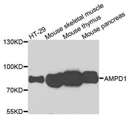 Western blot analysis of extracts of various cells using AMPD1 antibody