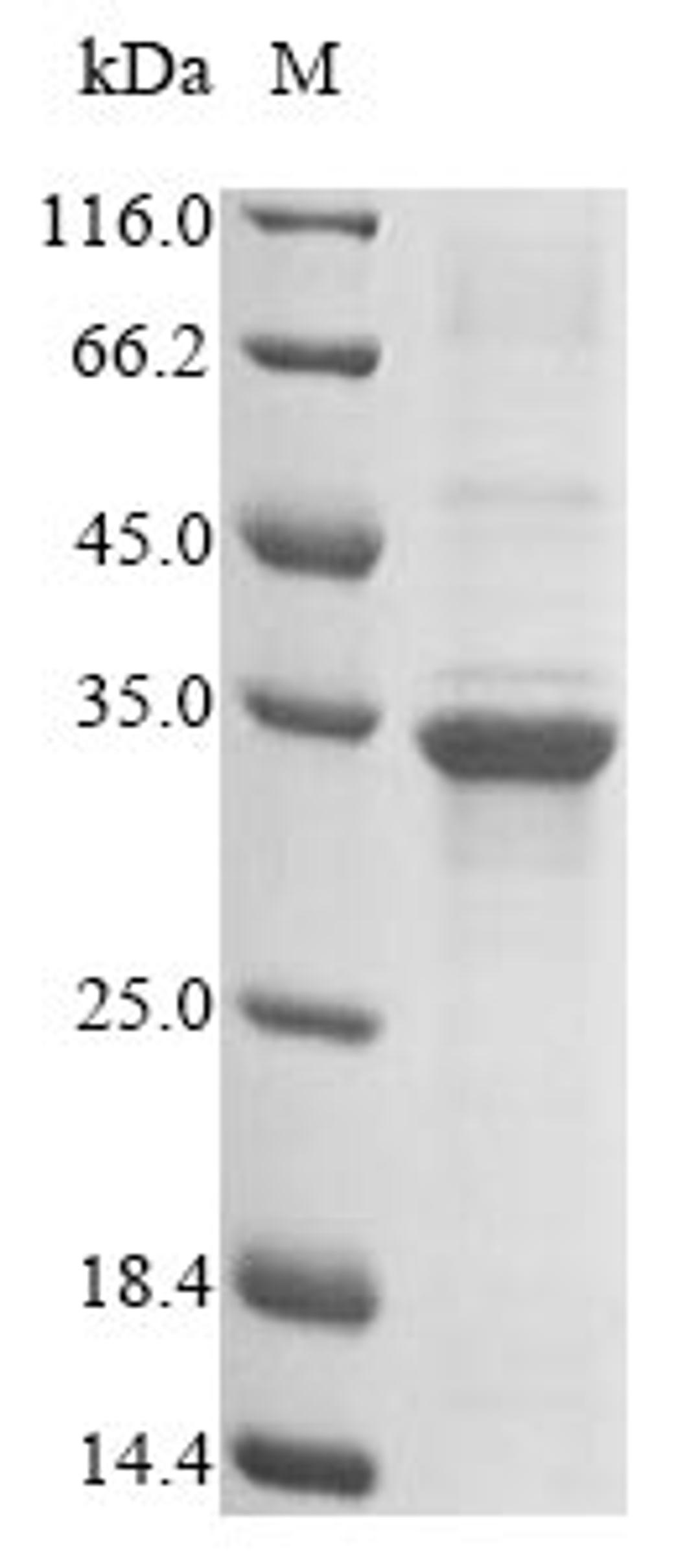 (Tris-Glycine gel) Discontinuous SDS-PAGE (reduced) with 5% enrichment gel and 15% separation gel.