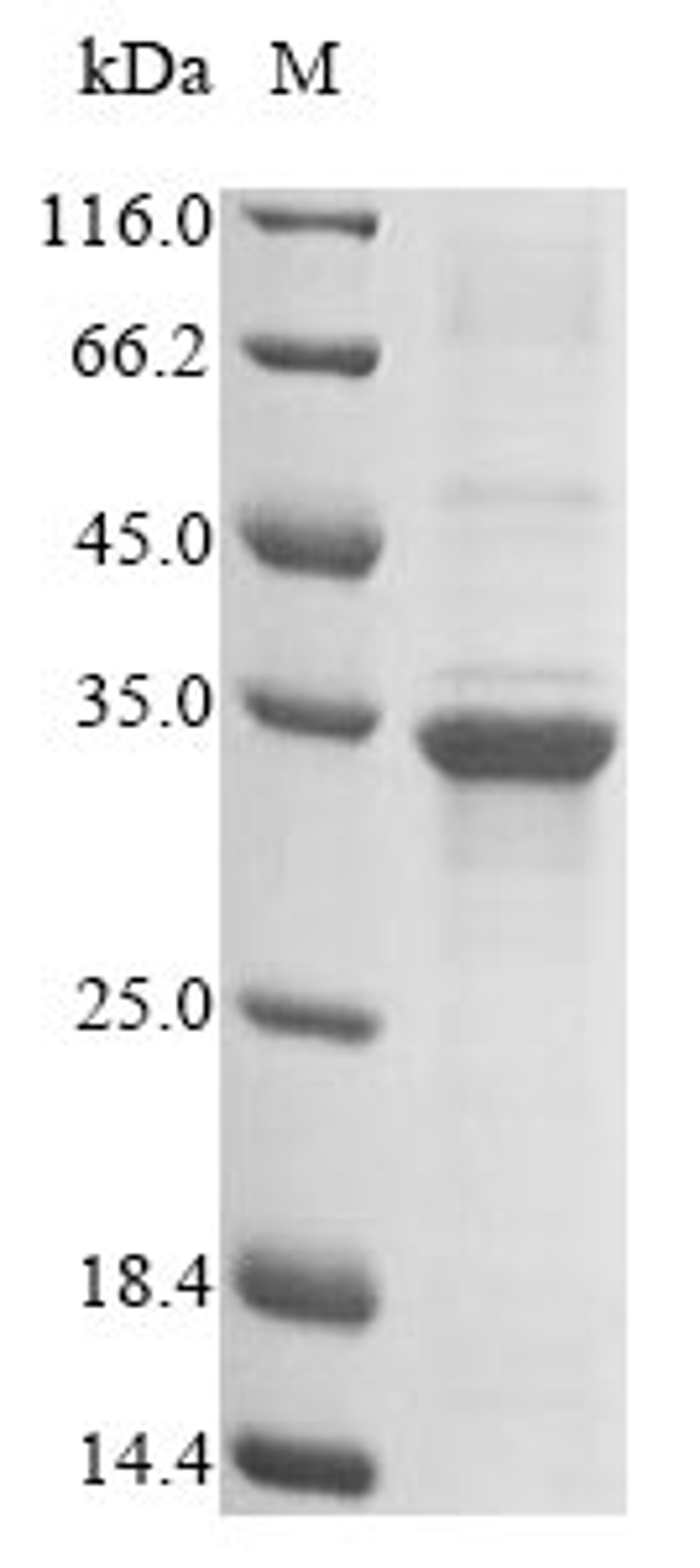 (Tris-Glycine gel) Discontinuous SDS-PAGE (reduced) with 5% enrichment gel and 15% separation gel.