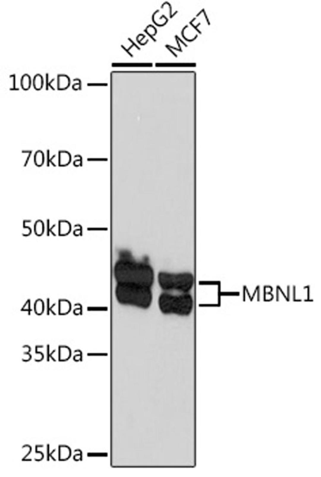 Western blot - MBNL1 Rabbit mAb (A5149)