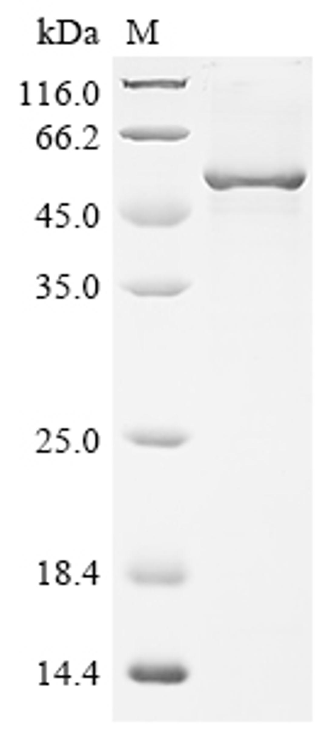(Tris-Glycine gel) Discontinuous SDS-PAGE (reduced) with 5% enrichment gel and 15% separation gel.