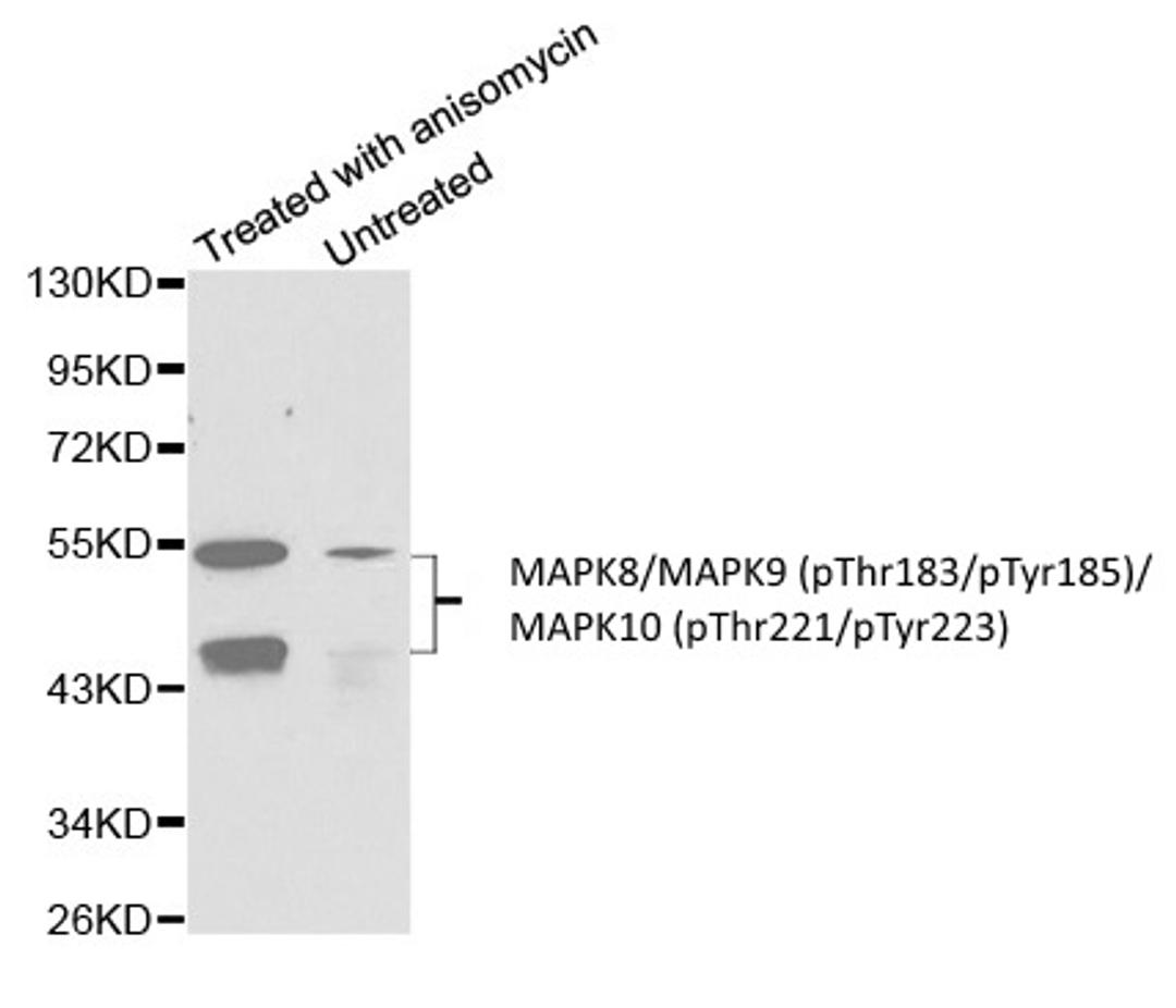 Western blot analysis of C6 cell lysate untreated or treated with anisomycin