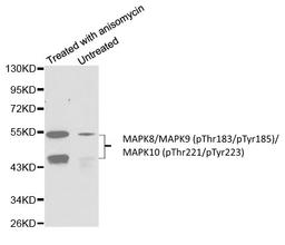 Western blot analysis of C6 cell lysate untreated or treated with anisomycin