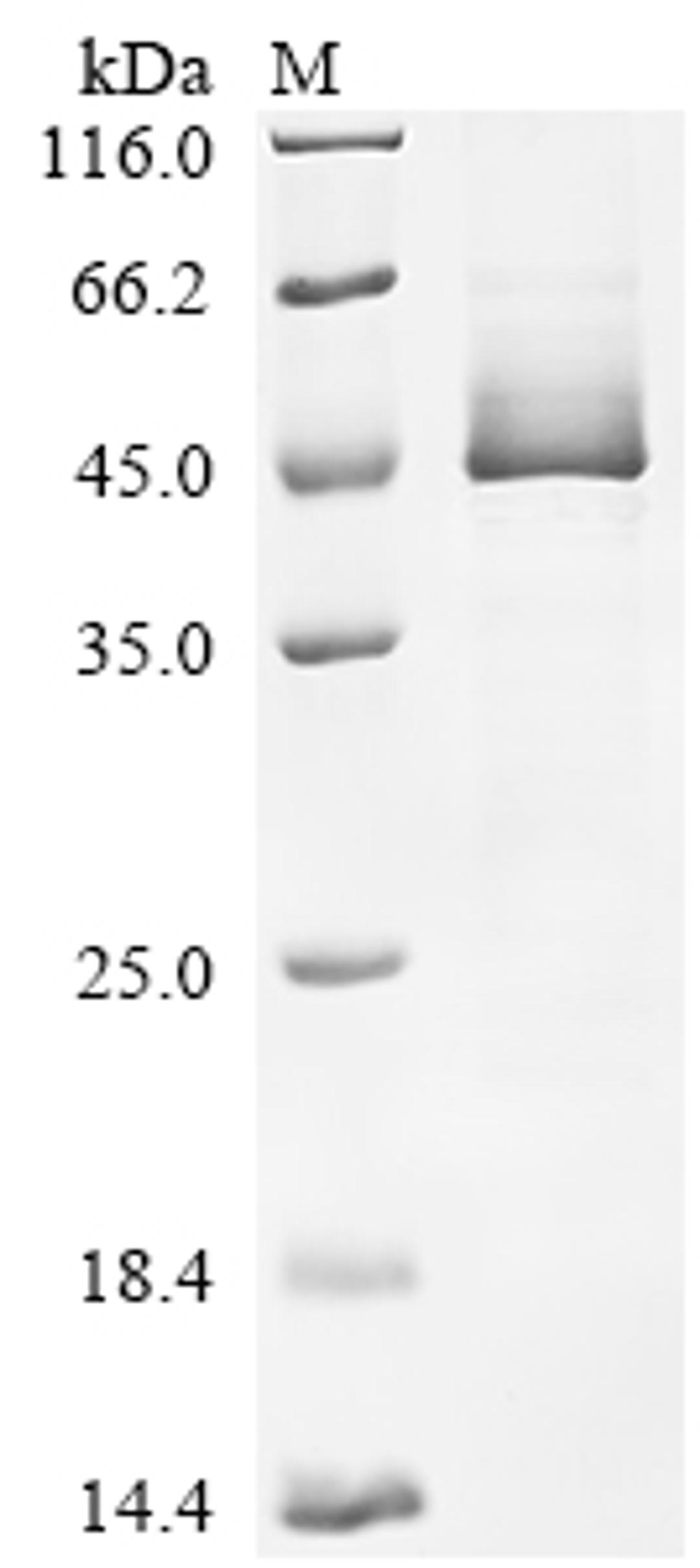 (Tris-Glycine gel) Discontinuous SDS-PAGE (reduced) with 5% enrichment gel and 15% separation gel.