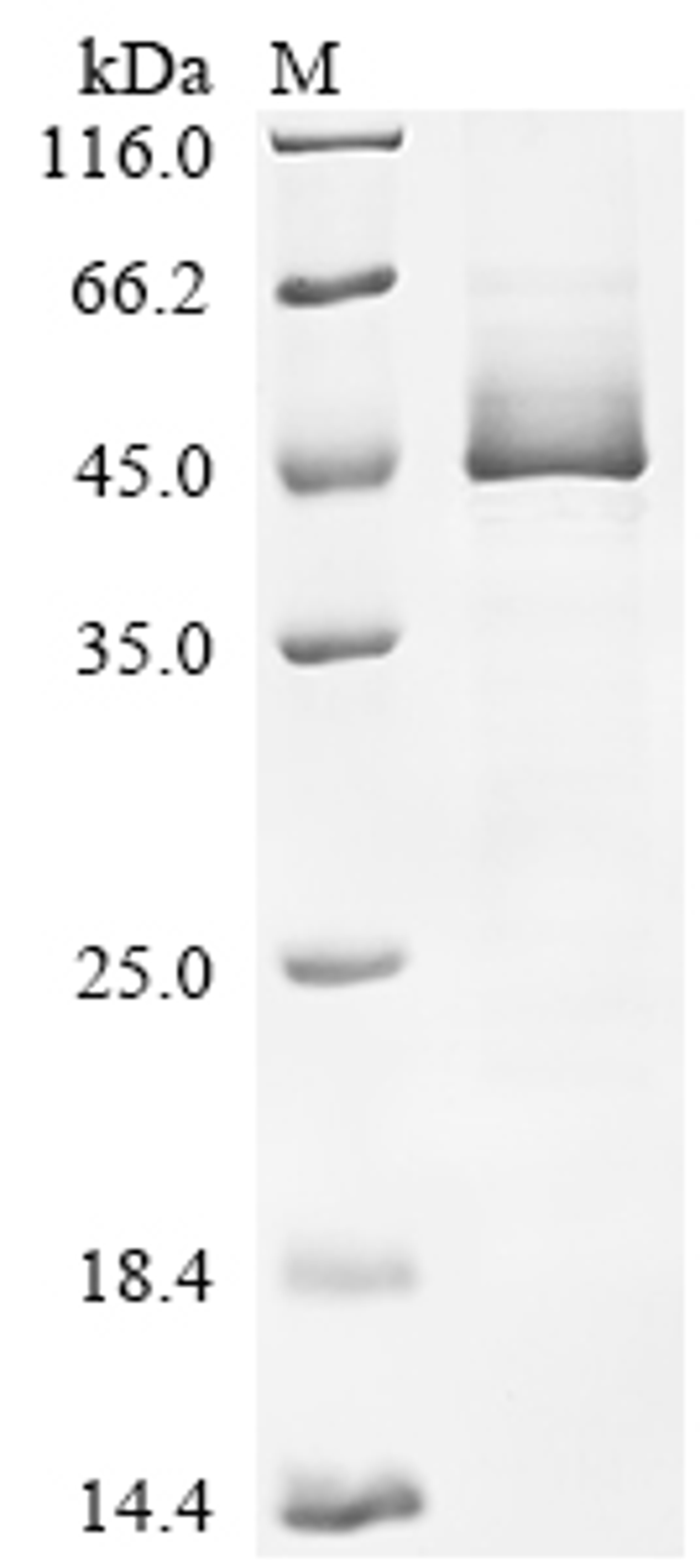 (Tris-Glycine gel) Discontinuous SDS-PAGE (reduced) with 5% enrichment gel and 15% separation gel.