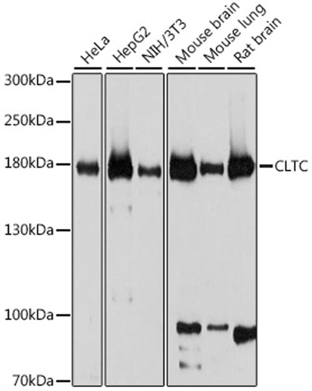 Western blot - CLTC antibody (A12423)