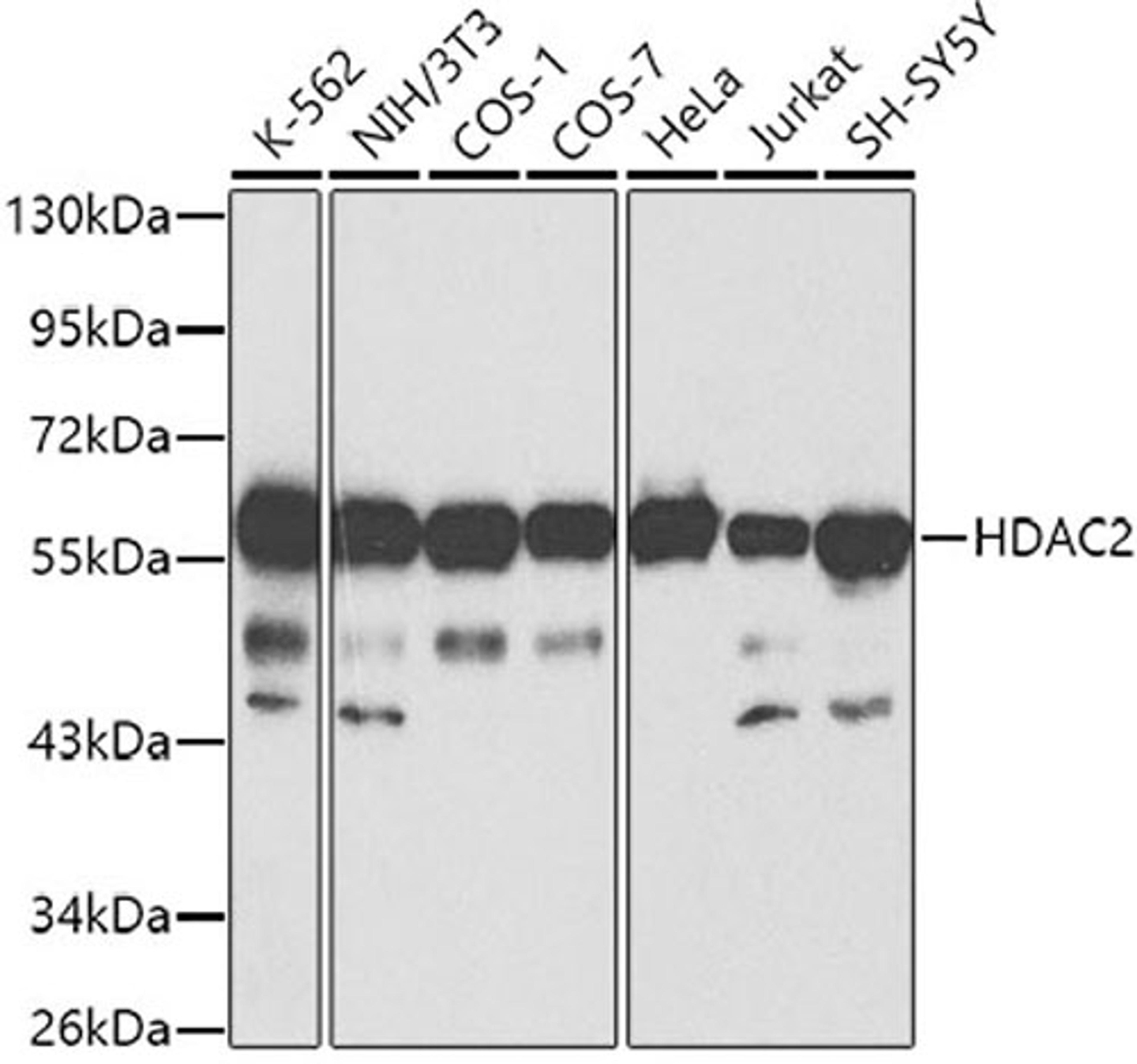 Western blot - HDAC2 antibody (A2084)