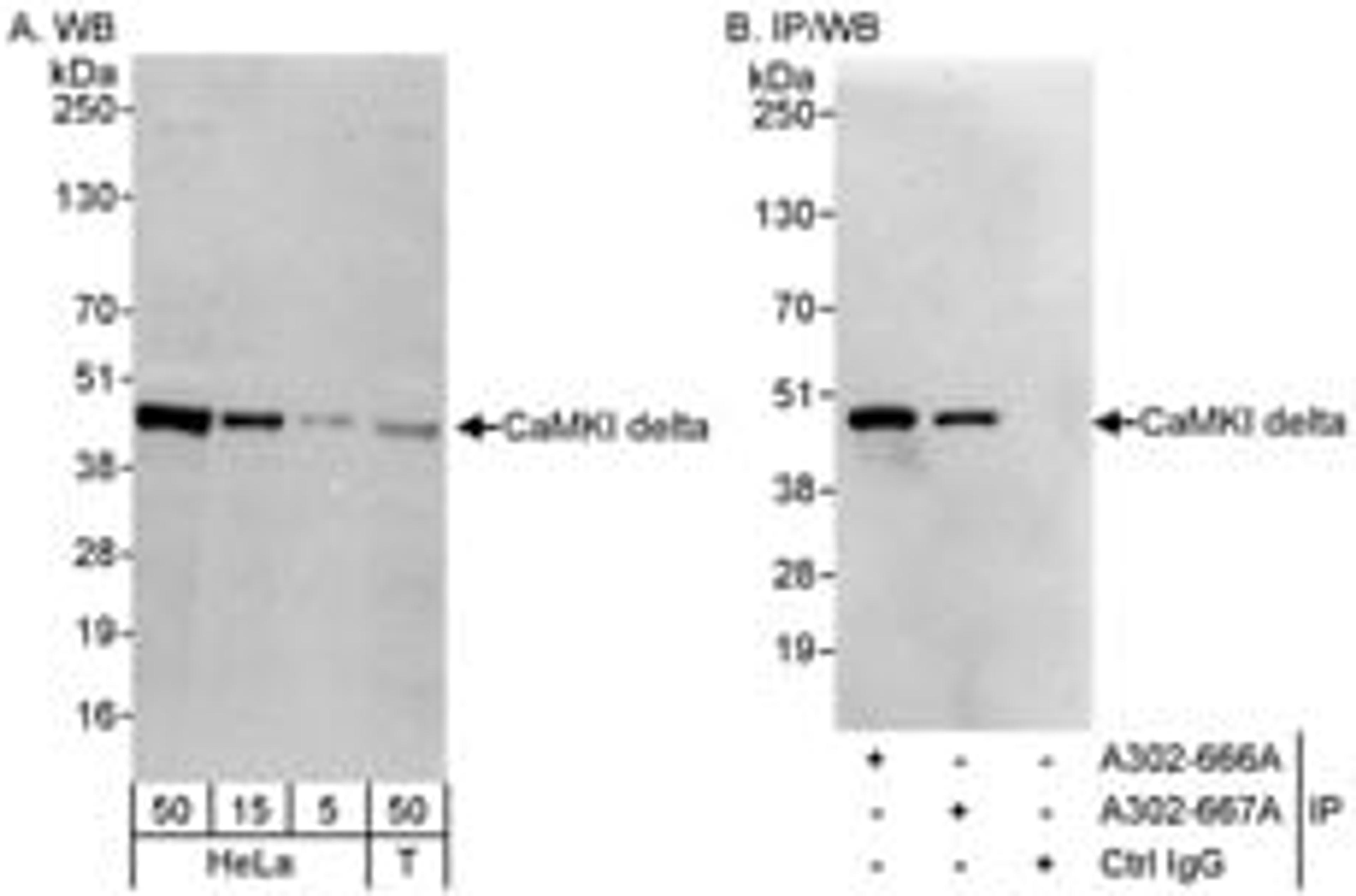 Detection of human CaMKI delta by western blot and immunoprecipitation.