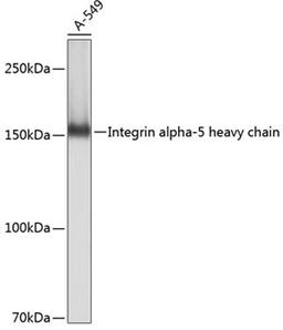 Western blot - Integrin alpha 5 antibody (A19069)