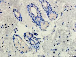 Immunohistochemical staining of rat skin tissue using CD206 antibody (dilution of primary antibody - 1:200)