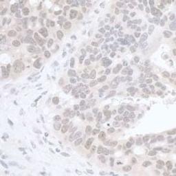 Detection of human RIF1 by immunohistochemistry.