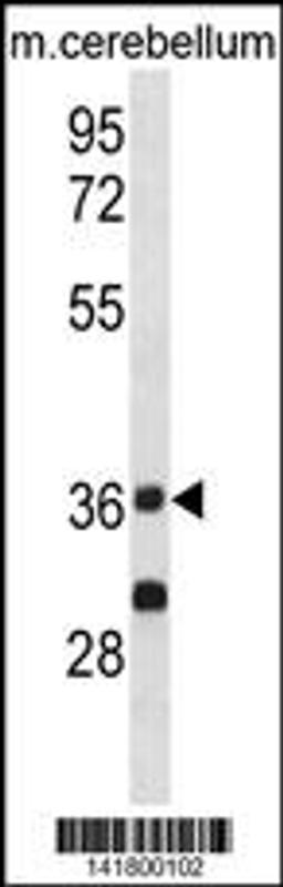 Western blot analysis in mouse cerebellum tissue lysates (35ug/lane).