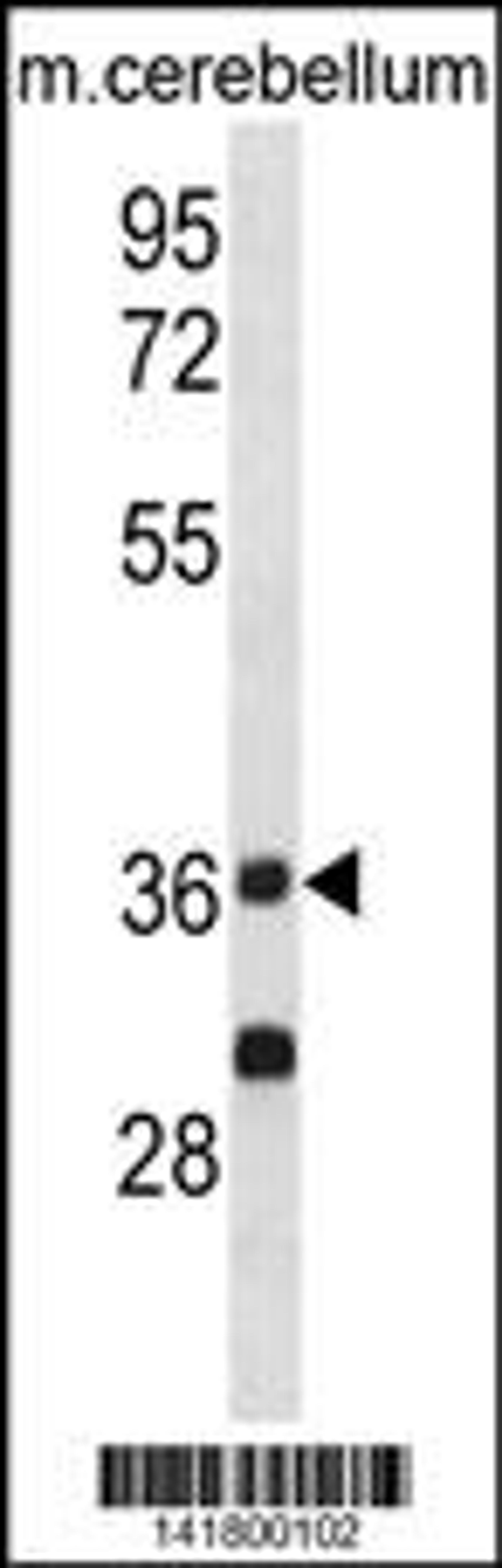 Western blot analysis in mouse cerebellum tissue lysates (35ug/lane).