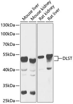 Western blot - DLST antibody (A13297)