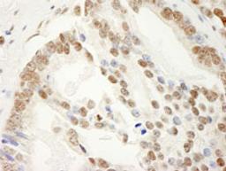 Detection of human SAM68 by immunohistochemistry.