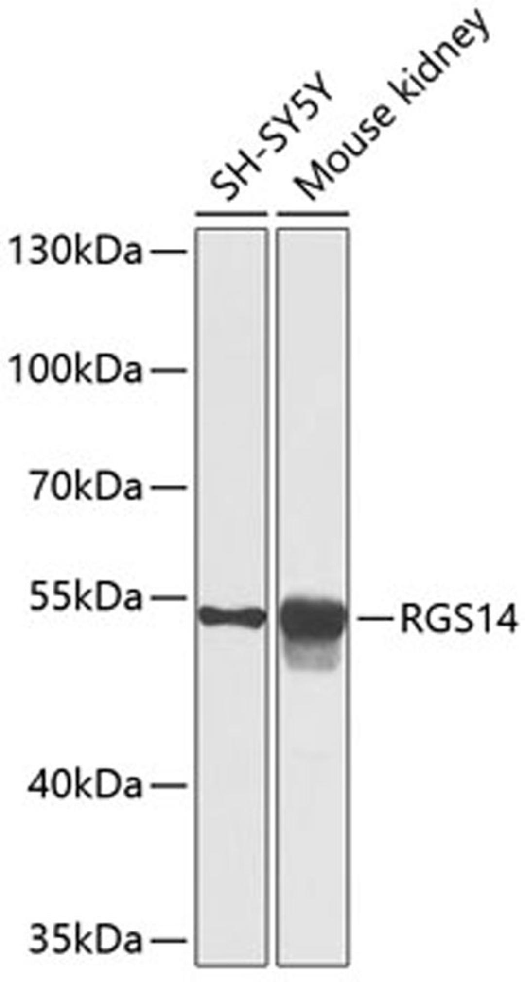 Western blot - RGS14 antibody (A9962)