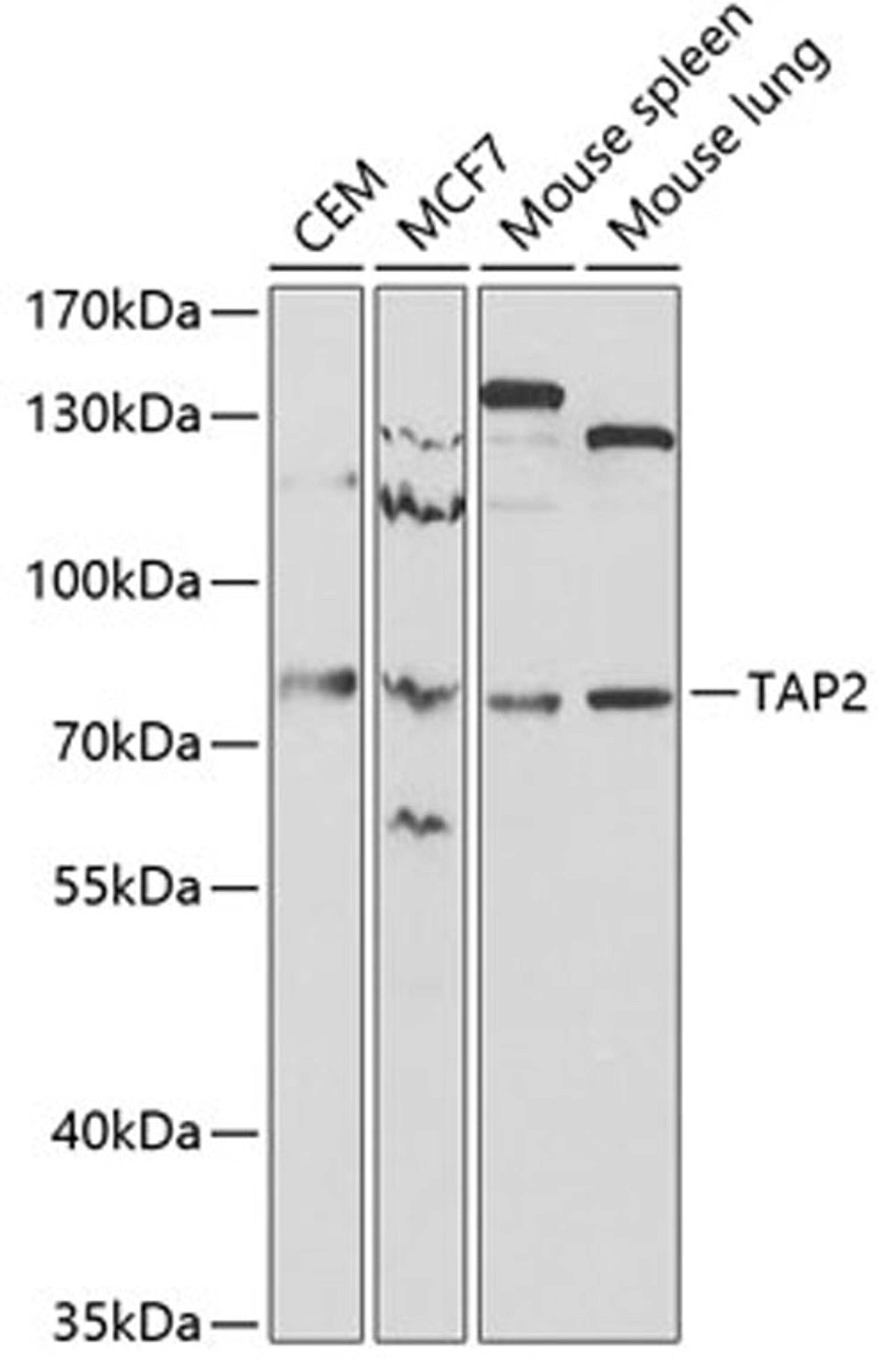 Western blot - TAP2 antibody (A1610)