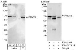 Detection of human PRMT3 by western blot and immunoprecipitation.