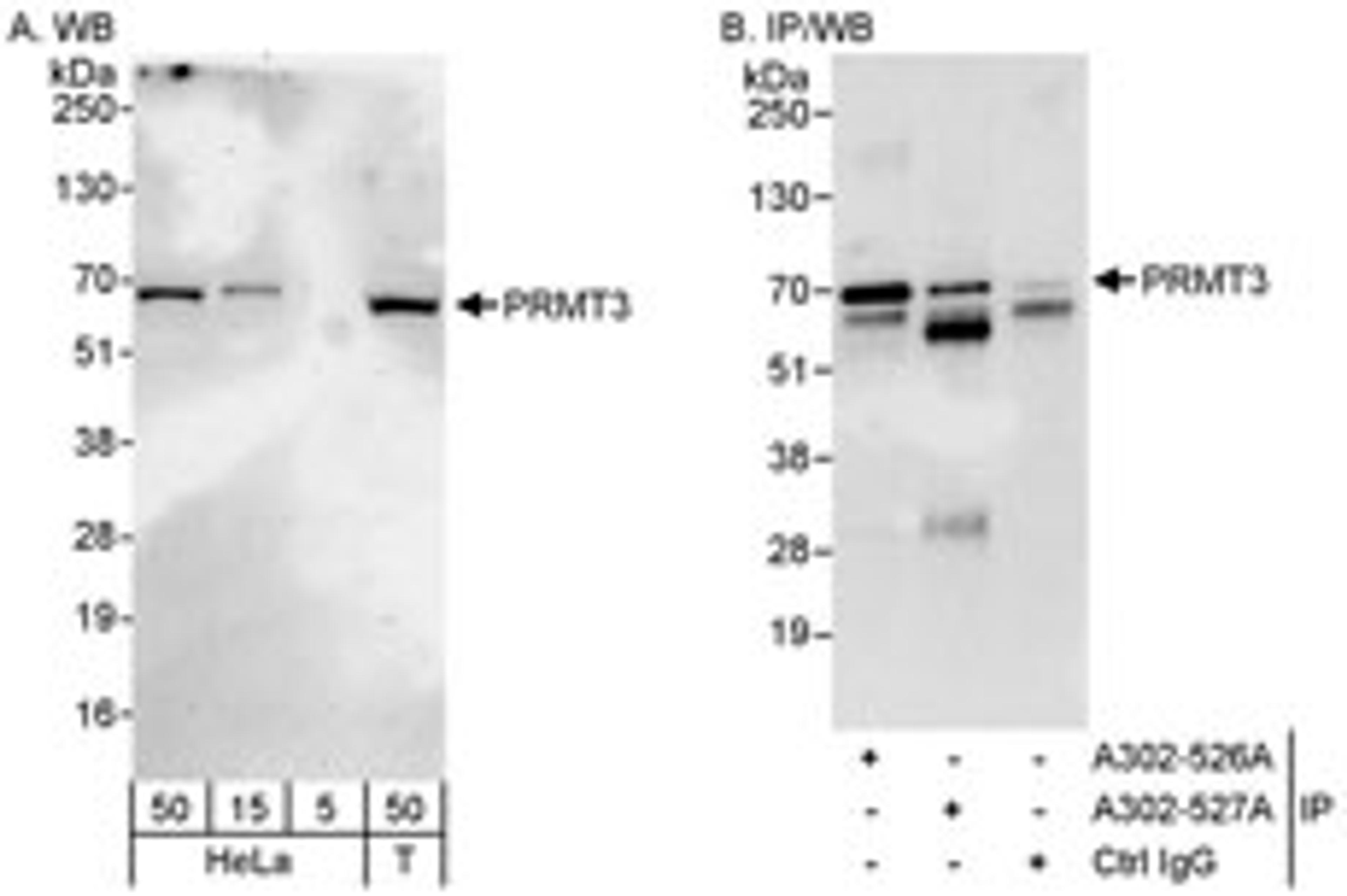 Detection of human PRMT3 by western blot and immunoprecipitation.