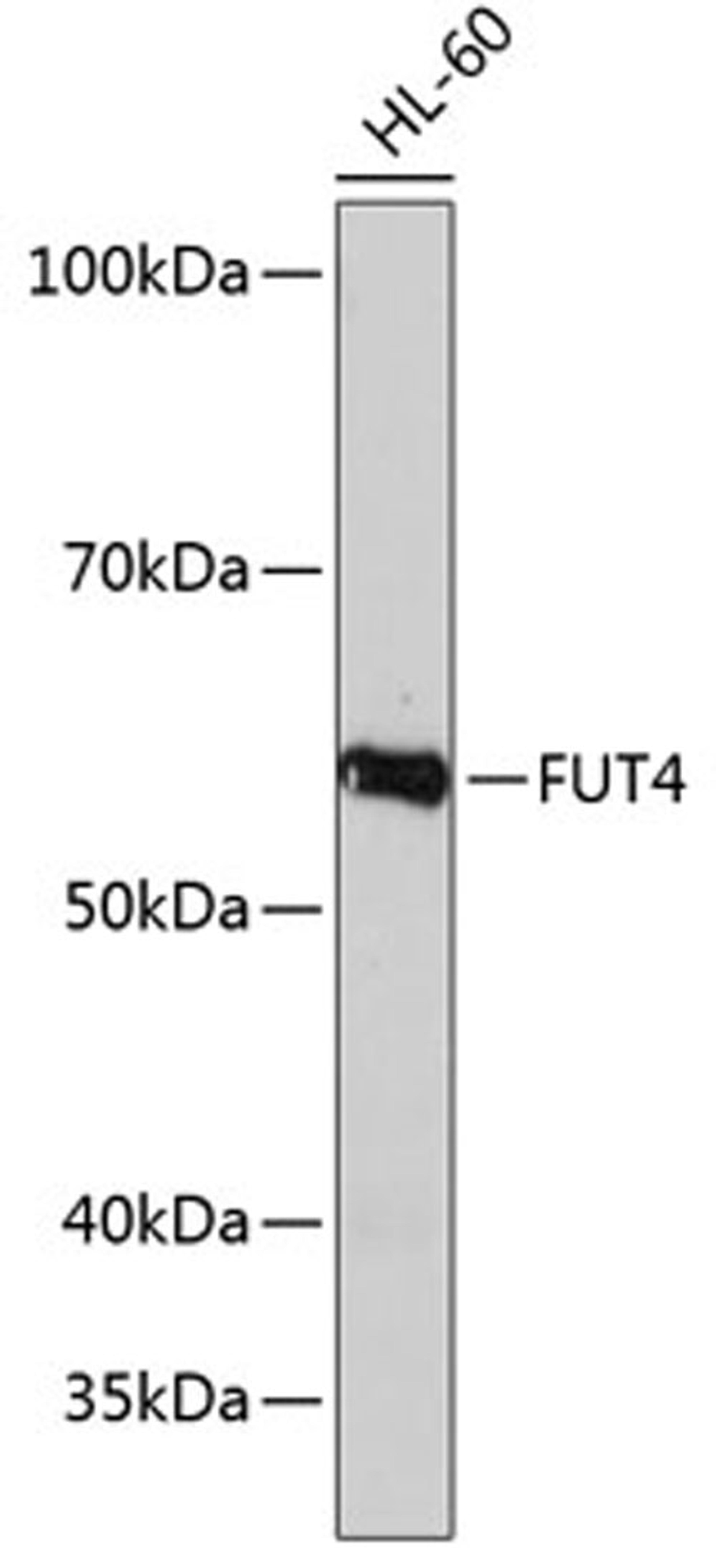 Western blot - FUT4 Polyclonal Antibody (A16320)