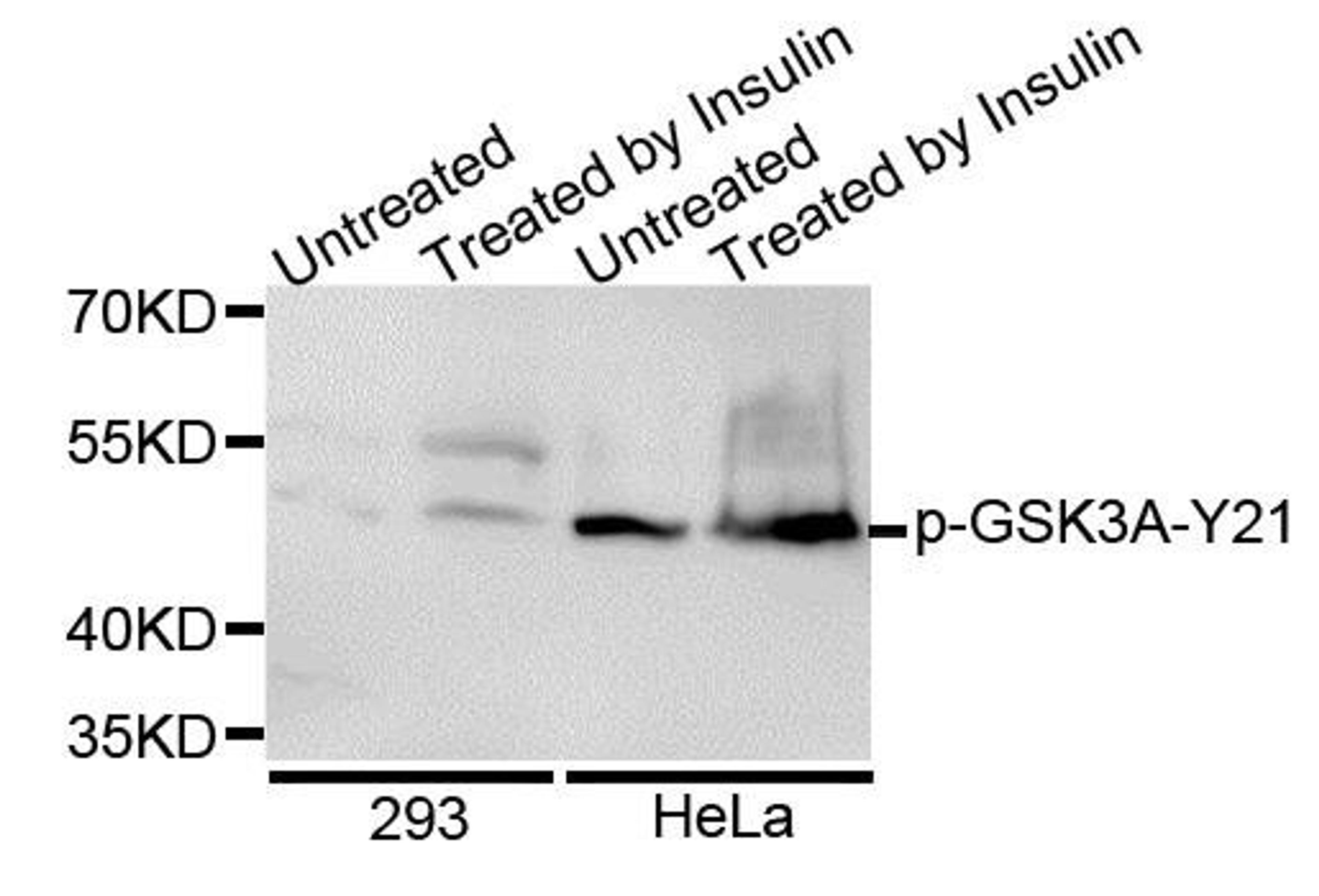 Western blot analysis of extracts of various cell lines using GSK3A (Phospho-S21) antibody