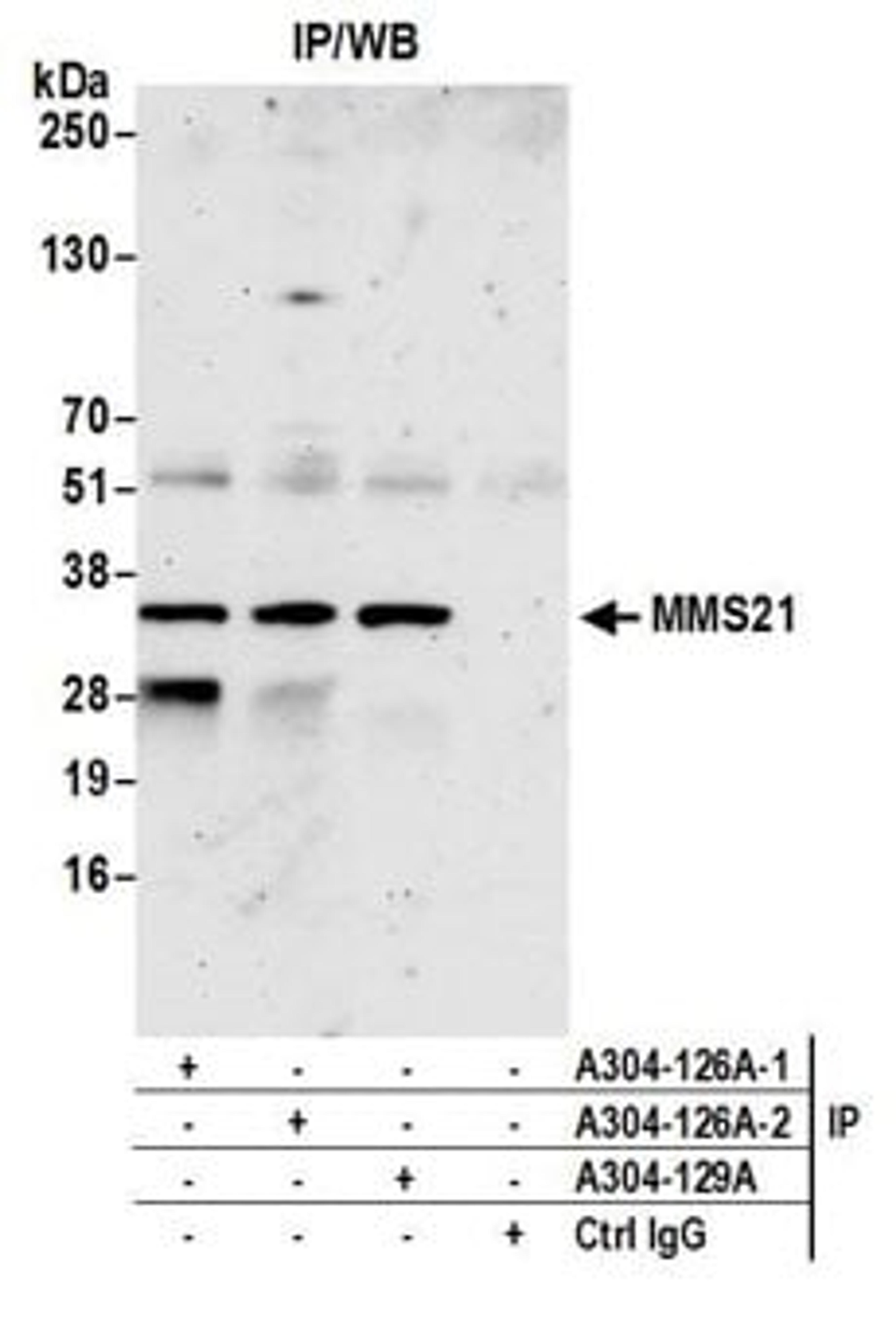 Detection of human MMS21 by western blot of immunoprecipitates.