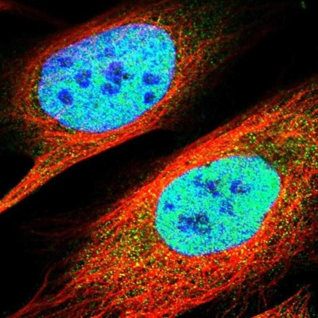 Immunocytochemistry/Immunofluorescence: TBLR1 Antibody [NBP1-89880] - Staining of human cell line U-2 OS shows positivity in nuclei but not nucleoli.