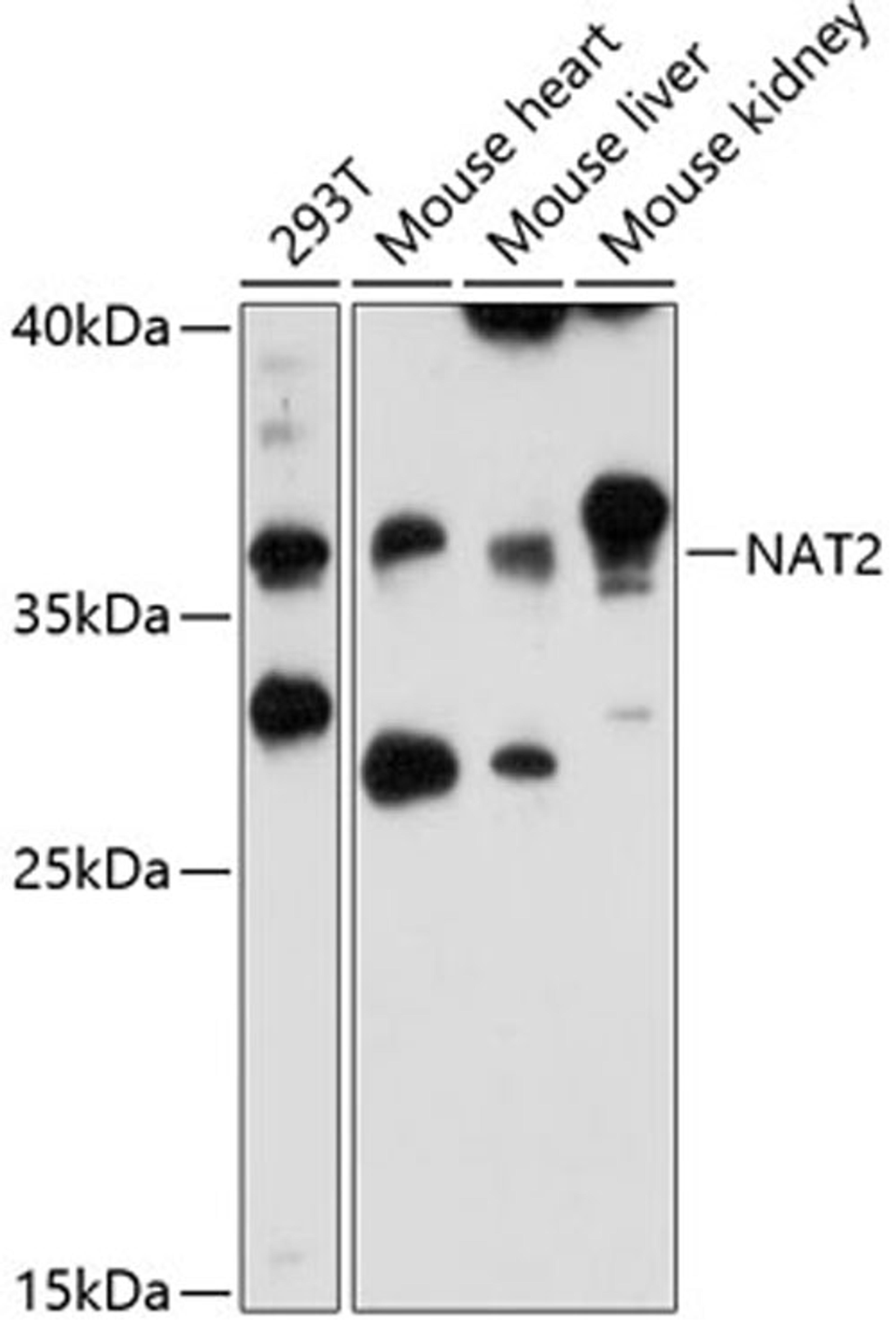 Western blot - NAT2 antibody (A12766)