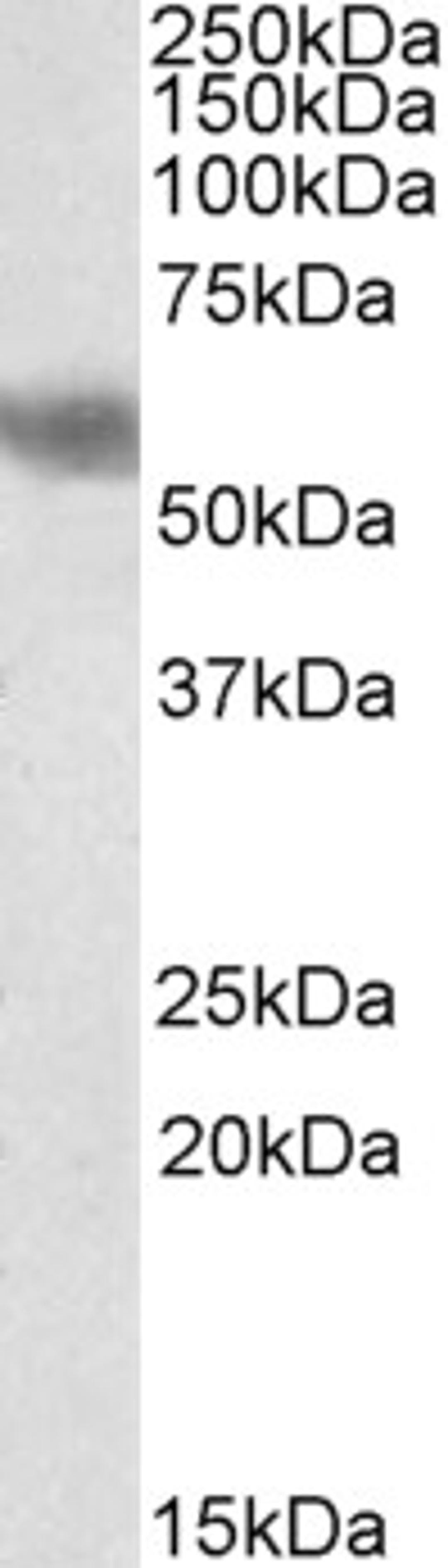 45-507 (2ug/ml) staining of Human Cerebellum (A), Mouse (B), and Rat (C) Brain lysate (35ug protein in RIPA buffer). Primary incubation was 1 hour. Detected by chemiluminescence.