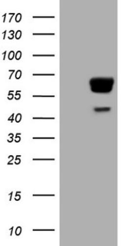 Western Blot: PAK4 Antibody (1C7) [NBP2-46316] - Analysis of HEK293T cells were transfected with the pCMV6-ENTRY control (Left lane) or pCMV6-ENTRY PAK4.