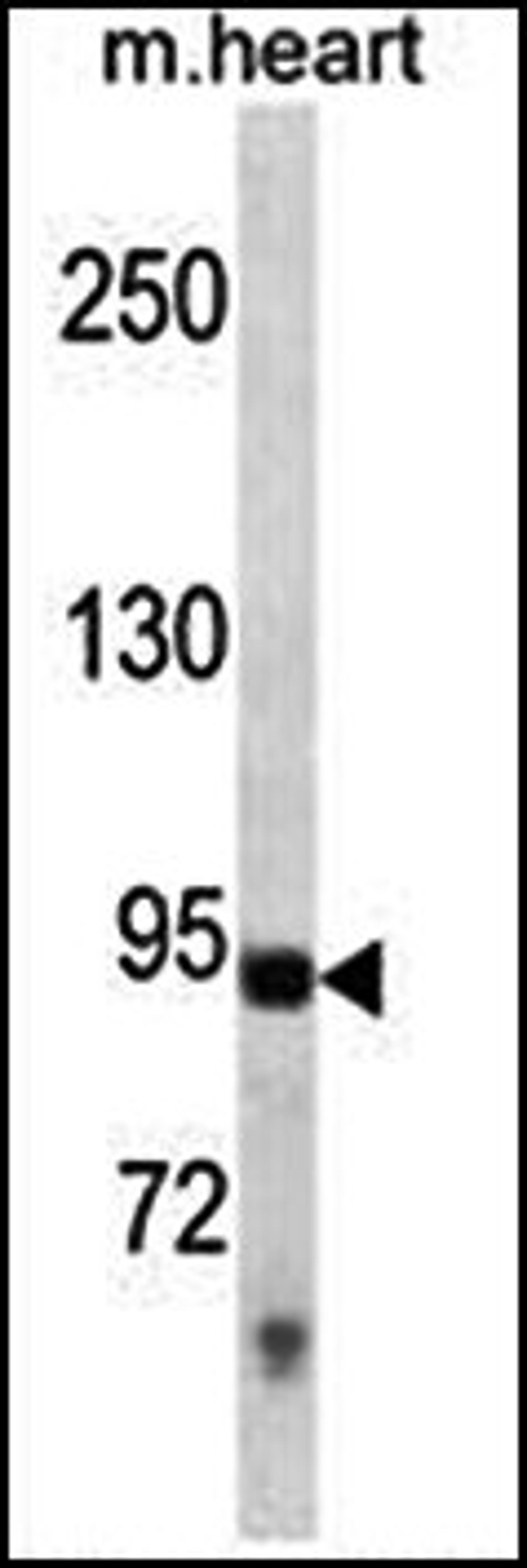 Western blot analysis of mouse heart tissue lysates (35ug/lane) using TLR3 antibody