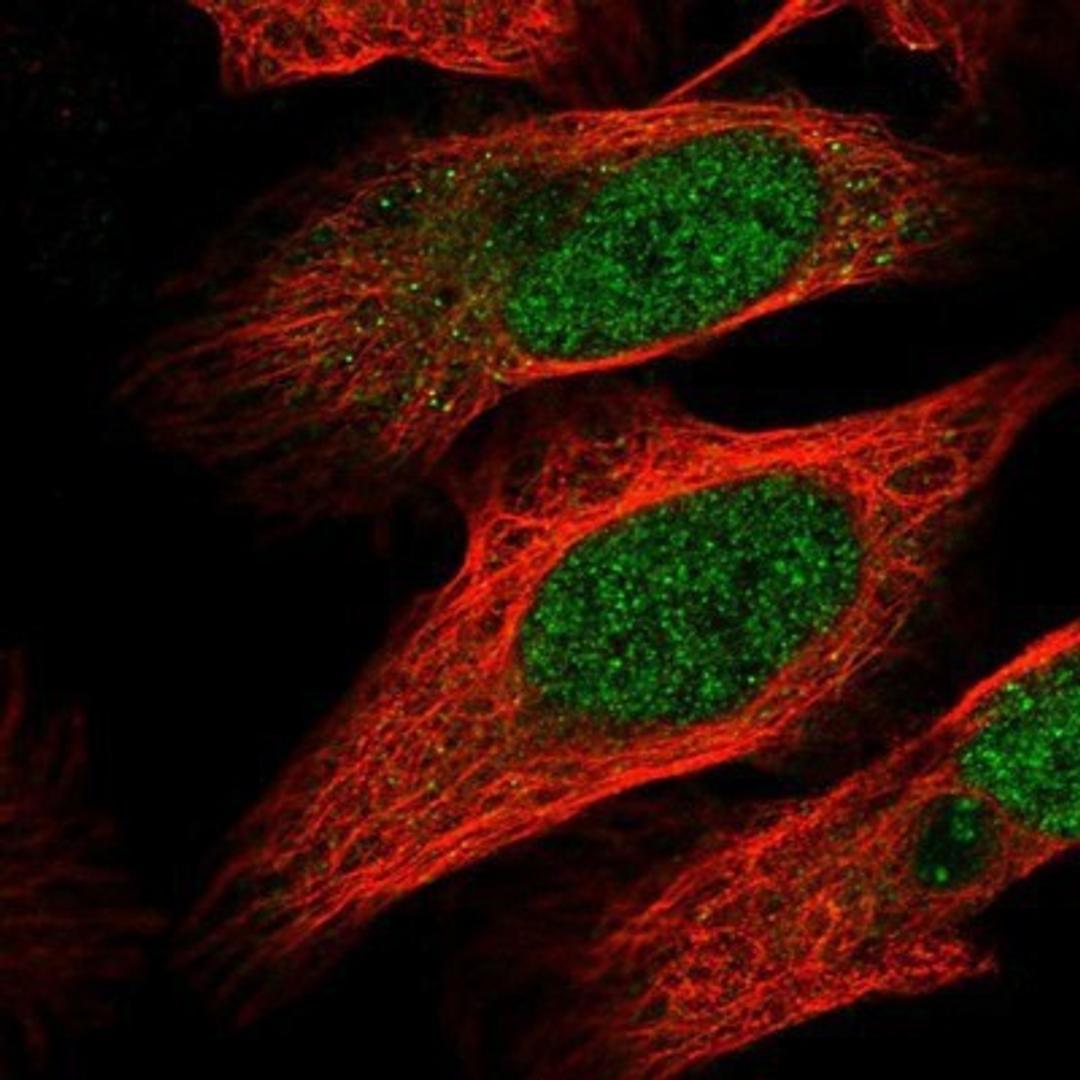 Immunocytochemistry/Immunofluorescence: MTF1 Antibody [NBP1-86380] - Staining of human cell line U-2 OS shows positivity in nucleus but not nucleoli.