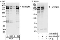 Detection of human Huntingtin by western blot and immunoprecipitation.