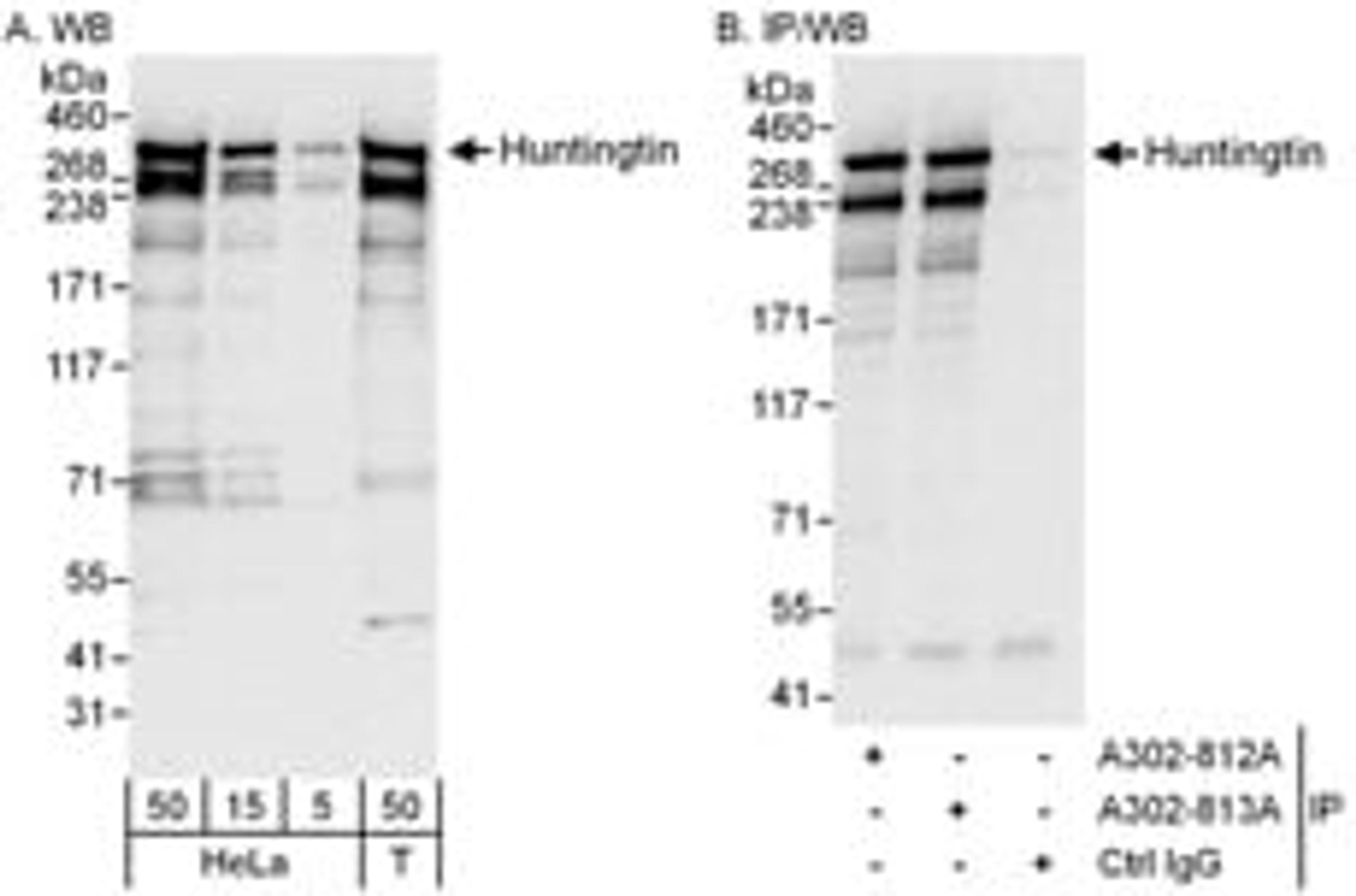 Detection of human Huntingtin by western blot and immunoprecipitation.