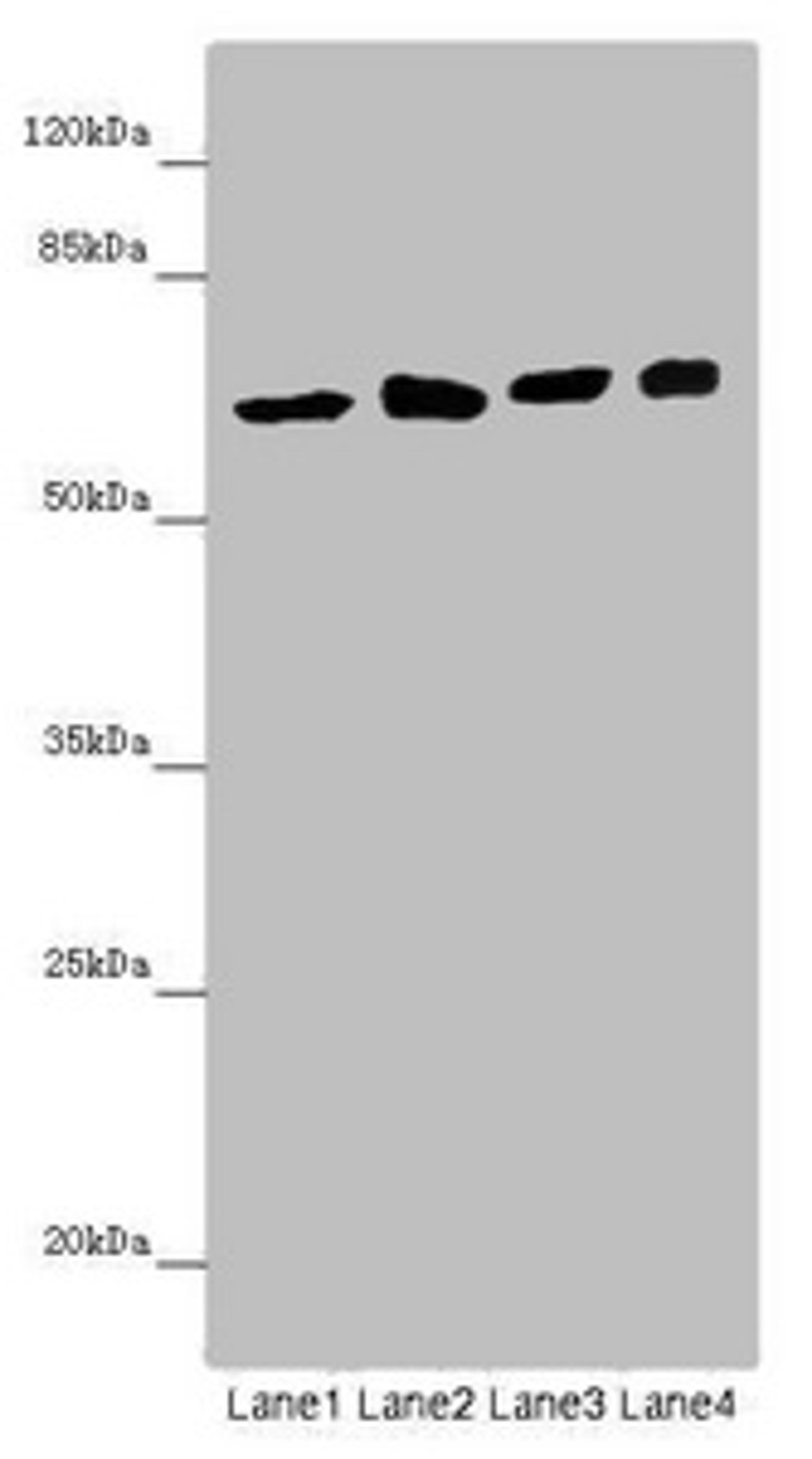 Western blot. All lanes: SOCS4 antibody at 4.39 ug/ml. Lane 1: Mouse kidney tissue. Lane 2: Jurkat whole cell lysate. Lane 3: A549 whole cell lysate. Lane 4: 293T whole cell lysate. Secondary. Goat polyclonal to rabbit IgG at 1/10000 dilution. Predicted band size: 60 kDa. Observed band size: 60 kDa. 