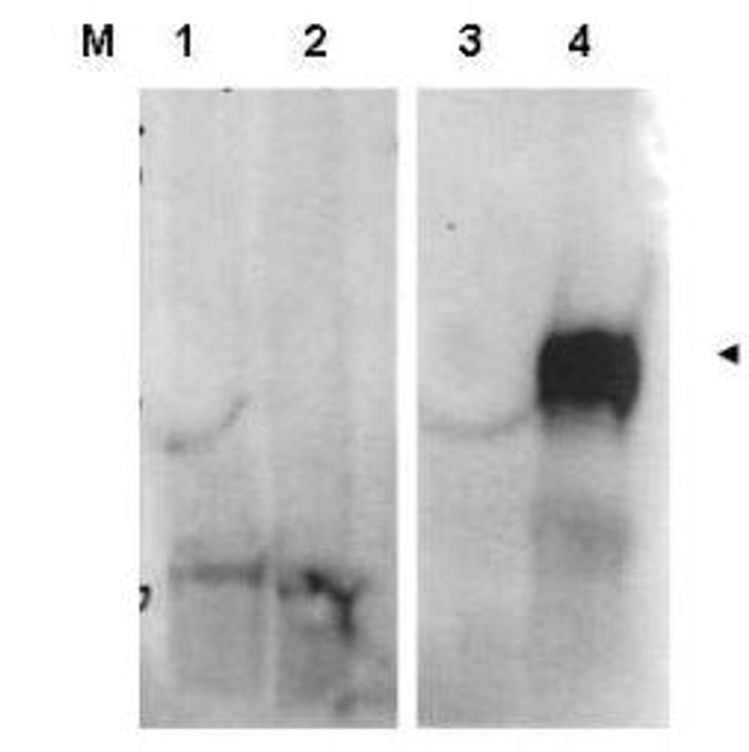 Western blot analysis of whole cell lysates from FAP expressing HEK cells (lane 4) but not control HEK cells (lane 3) using Fibroblast Activation Protein antibody