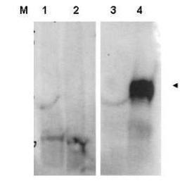 Western blot analysis of whole cell lysates from FAP expressing HEK cells (lane 4) but not control HEK cells (lane 3) using Fibroblast Activation Protein antibody