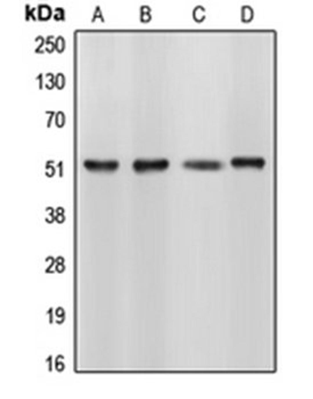 Western blot analysis of HL60 (Lane 1), HeLa (Lane 2), NIH3T3 (Lane 3), Sol8 (Lane 4) whole cell lysates using CELF1 antibody